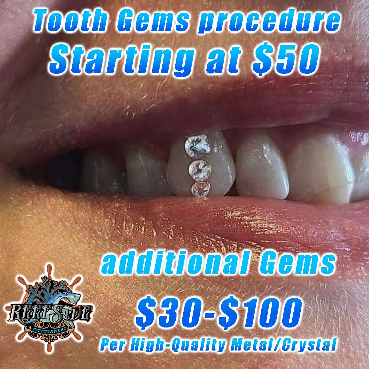 Get Your Free Consultation For Tooth Gems In Melbourne, FL